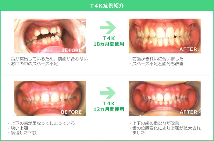 T4K症例画像